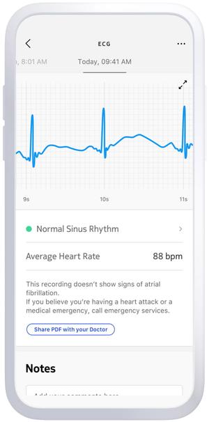 Withings BPM Core